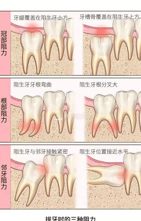 序齿排班：年龄排序下的猴子故事与拱伏无畏