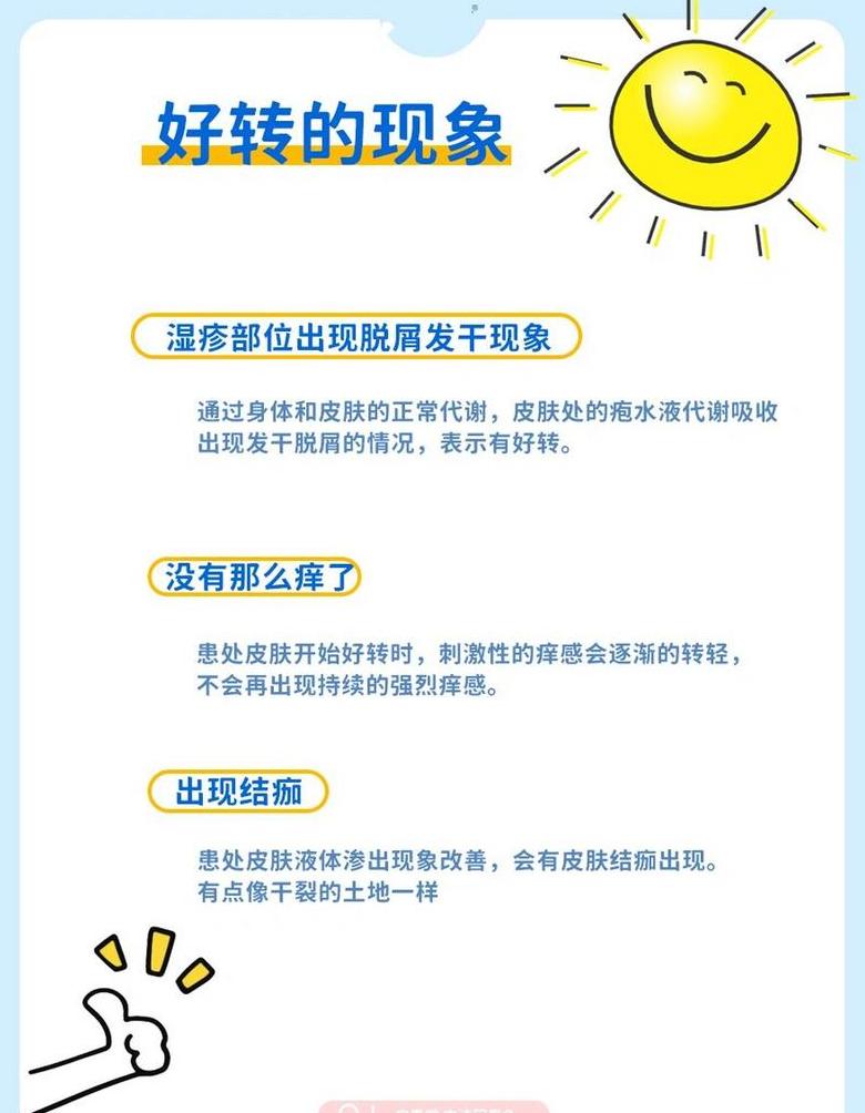 湿疹自愈可能性及治疗要点