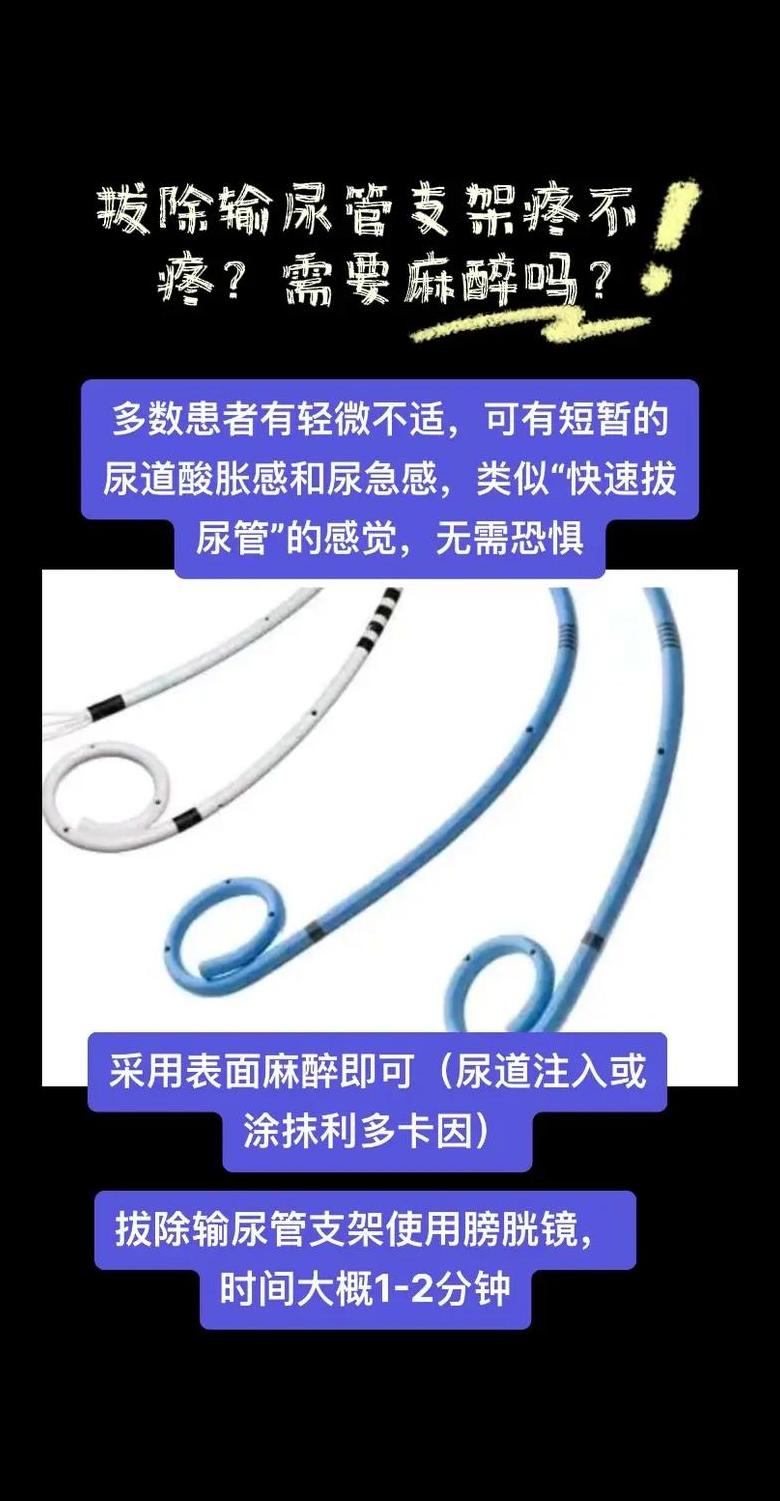 输尿管镜取支架会有什么影响